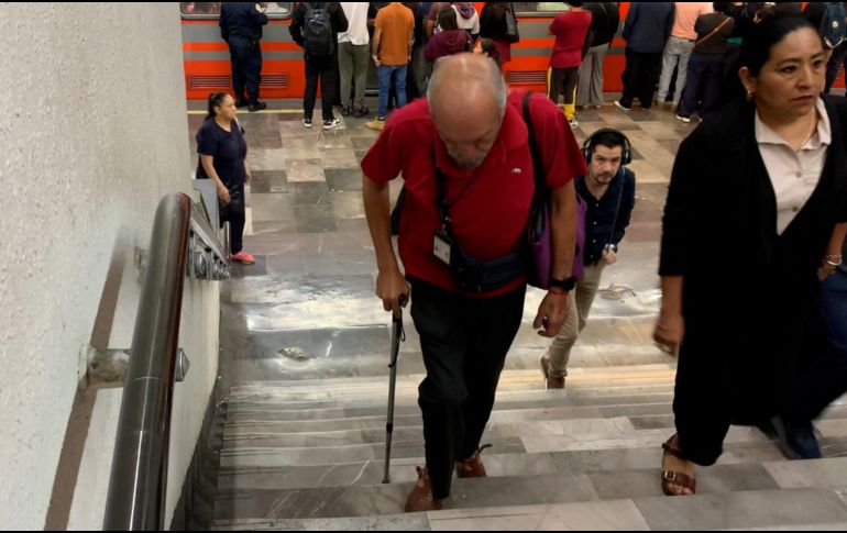 La hinchazón de las piernas producida por la retención de líquidos en los tejidos de las extremidades inferiores se conoce como edema periférico. SUN / ARCHIVO