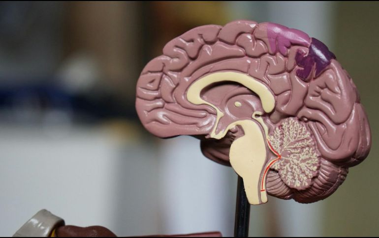 Las enfermedades neurodegenerativas, como el Alzheimer y el Parkinson, representan uno de los mayores desafíos de salud pública a nivel mundial. Unsplash.