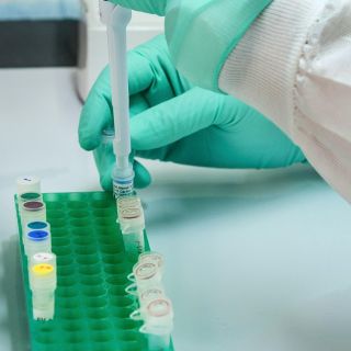 Un análisis de sangre podría predecir la enfermedad de Párkinson