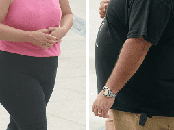 Según expertos en salud, más del 70% de personas con obesidad podrían desarrollar hígado graso, lo cual, dicen, inicialmente no tiene mayor sintomatología. AFP / ARCHIVO