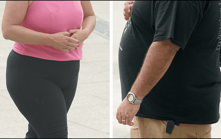 Según expertos en salud, más del 70% de personas con obesidad podrían desarrollar hígado graso, lo cual, dicen, inicialmente no tiene mayor sintomatología. AFP / ARCHIVO