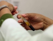 El tacto rectal es una exploración muy sencilla y rápida, y en menos de un minuto se puede tener el panorama de lo que ocurre en la próstata, sumado a la prueba del antígeno prostático que se realiza en sangre. SUN / ARCHIVO