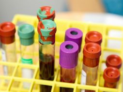 La OMS recomendó que el medicamento sea accesible en todo el mundo. UNSLASH / NCI