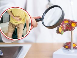 Si experimentas alguno de estos síntomas de manera persistente o grave, es fundamental buscar atención médica inmediatamente. Los problemas hepáticos pueden ser graves y potencialmente mortales si no se tratan adecuadamente. CANVA