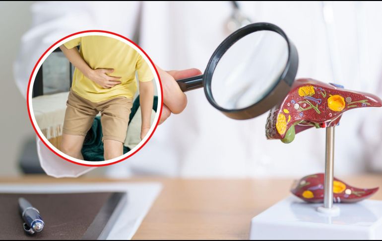 Si experimentas alguno de estos síntomas de manera persistente o grave, es fundamental buscar atención médica inmediatamente. Los problemas hepáticos pueden ser graves y potencialmente mortales si no se tratan adecuadamente. CANVA