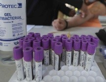 El cáncer de próstata es una de las enfermedades silenciosas en las primeras etapas. SUN / ARCHIVO