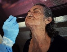 Las personas infectadas con el virus COVID-19, experimentan rasgos de una enfermedad respiratoria de leve a moderada que suelen escalar dependiendo del paciente, siendo los adultos mayores la población más vulnerable. AFP / ARCHIVO