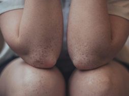 Estos son los cuidados que puedes tener para mantener tus codos hidratados. ESPECIAL / Unsplash Lucaxx Freire