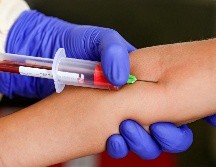 En términos generales, el de próstata representa un 15% de todos los cánceres masculinos. EFE / ARCHIVO