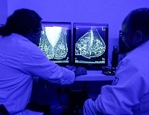 El cáncer de mama es una enfermedad donde se desarrollan células malignas en los tejidos de la mama. EL INFORMADOR / ARCHIVO