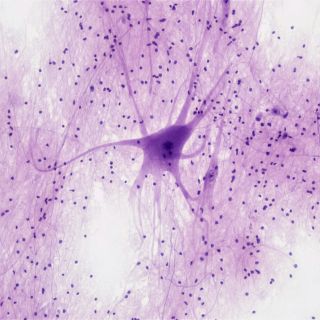 Neuronas a partir de células de la piel para estudiar el alzhéimer