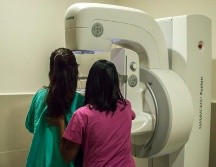 La mastografía de tamizaje consiste en un estudio de Rayos X que se realiza a las mujeres a partir de los 40 años y hasta los 69 años, por ser el grupo blanco de mayor riesgo. NTX / ARCHIVO