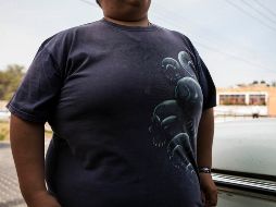 Conocido como “acantosis nigricans”, no sólo se presenta en el cuello, también puede aparecer en otras partes del cuerpo, manchando y engrosando porciones de piel. EL INFORMADOR / ARCHIVO