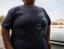 Conocido como “acantosis nigricans”, no sólo se presenta en el cuello, también puede aparecer en otras partes del cuerpo, manchando y engrosando porciones de piel. EL INFORMADOR / ARCHIVO