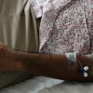 ¿Qué tengo qué hacer si me da mpox?