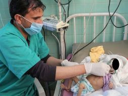 Las causas de este incremento son múltiples: brotes de enfermedades como el cólera y el sarampión. ESPECIAL / UNICEF