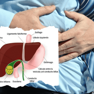Vesícula biliar: ¿Sabes qué tipos de cálculos puedes tener y cómo tratarlos? Te lo contamos
