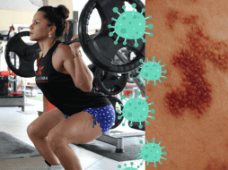 La tiña es una infección de la piel que puede contagiarse por el contacto con objetos contaminados. ESPECIAL/Imagen de Karolina Kaboompics en Pexels/Imagen de Fabiano Silva en Pixabay