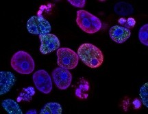 El estudio apunta a la intervención en los procesos de envejecimiento celular. UNSPLASH / NCI