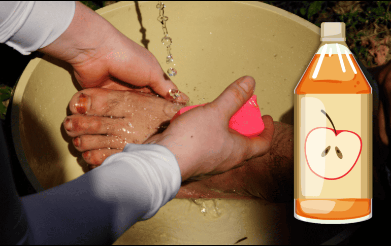 Los trastornos en los pies se evidencian en la piel como callos, juanetes, ampollas, sequedad cutánea o exceso de transpiración. NTX / ARCHIVO