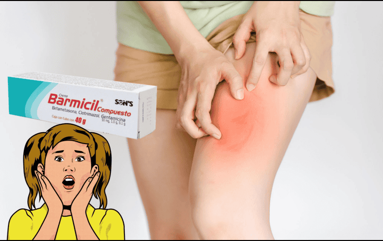 La autoridad sanitaria resalta que Barmicil contiene betametasona, un corticosteroide que, si se utiliza de forma inadecuada o durante períodos prolongados, puede alterar el equilibrio hormonal del organismo. Barmicil