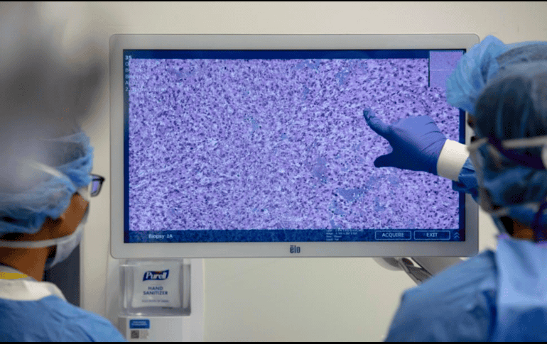 El éxito de CHIEF representa un cambio significativo en la forma en que se diagnostican y tratan los cánceres. NYU Langone Health