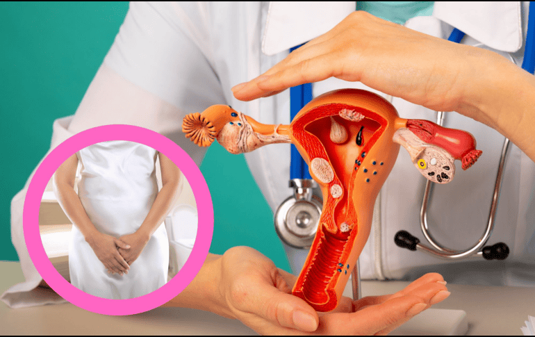 El uso de antibióticos es fundamental para tratar infecciones bacterianas, pero es importante ser consciente de sus efectos secundarios, como el riesgo de infecciones vaginales. CANVA