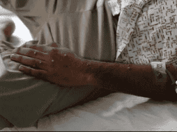 Este contagio, de acuerdo con el gobierno de Morelos, corresponde a la variante ll de Mpox. EFE/ARCHIVO