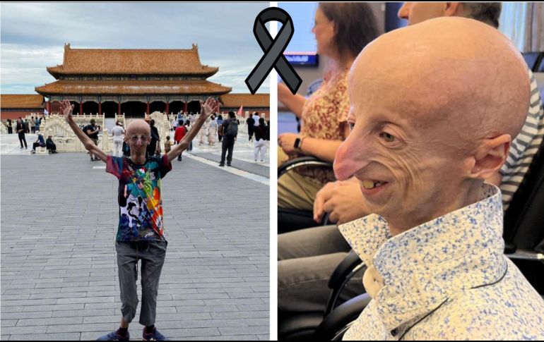 El científico apareció en un documental de National Geographic abocado a la divulgación de la progeria. ESPECIAL / Instagram @sammybasso