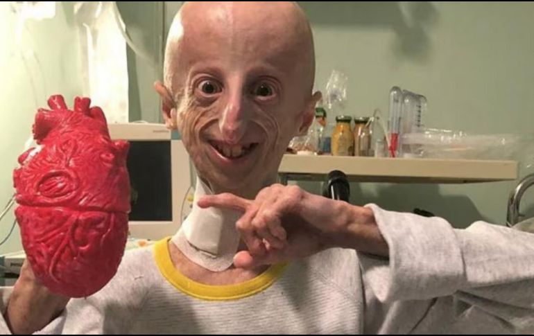 El científico italiano Sammy Basso falleció el pasado 6 de octubre a los 28 años de edad. Él padecía progeria y fue reconocido por dar visibilidad y estudiar su propia enfermedad. SUN / ESPECIAL / Sammy Basso