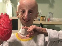 El científico italiano Sammy Basso falleció el pasado 6 de octubre a los 28 años de edad. Él padecía progeria y fue reconocido por dar visibilidad y estudiar su propia enfermedad. SUN / ESPECIAL / Sammy Basso