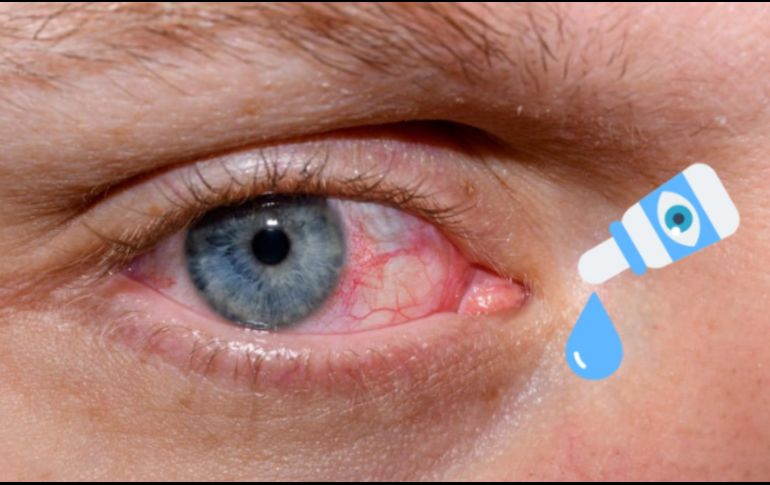 El síndrome del ojo seco es una condición que puede afectar la calidad de vida, pero su diagnóstico temprano y tratamiento adecuado pueden proporcionar alivio significativo. CANVA