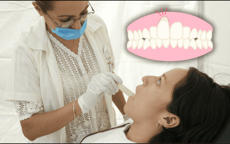 La ingivitis es común cuando las bacterias en la boca se multiplican y provocan inflamación. EL INFORMADOR / ARCHIVO