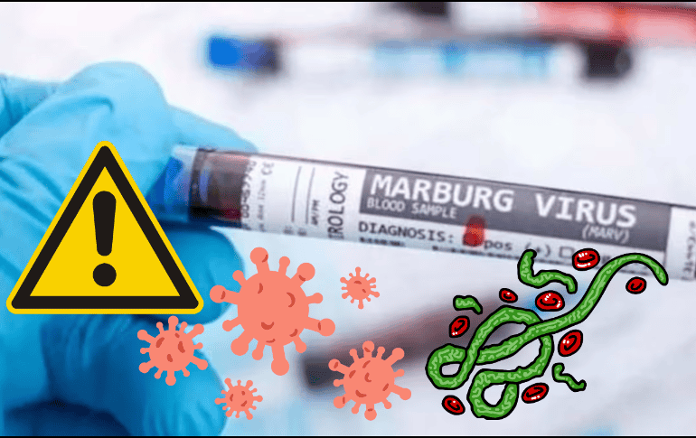 El virus de Marburgo, el cual provoca fiebre hemorrágica, está causando alerta a nivel global tras su rebrote a principios de este mes de octubre. ESPECIAL/ CANVA