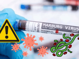 El virus de Marburgo, el cual provoca fiebre hemorrágica, está causando alerta a nivel global tras su rebrote a principios de este mes de octubre. ESPECIAL/ CANVA