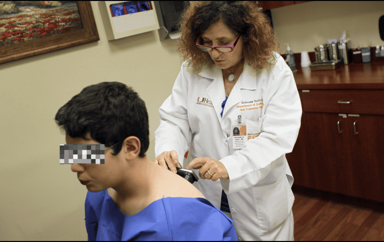 La enfermedad psoriásica interrumpe las rutinas, aumenta las responsabilidades domésticas y altera las actividades de esparcimiento. AFP / ARCHIVO