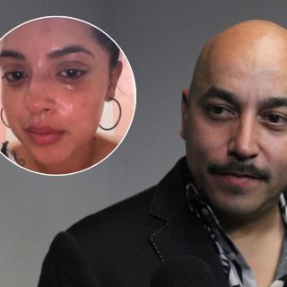 Abigail Rivera, hija de Lupillo Rivera, sufre grave accidente en el rostro