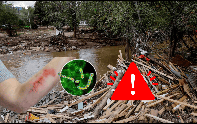 Tras el paso del huracán “Helene” por Florida en septiembre se han registrado 74 casos de contagio de la bacteria carnívora (vibrio vulnificus), además de 13 muertes. EFE/ ARCHIVO/ ESPECIAL