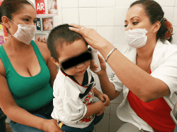 La otitis media aguda y crónica son las infecciones recurrentes del oído medio y las causas más frecuentes que provocan mastoiditis. EL INFORMADOR / ARCHIVO