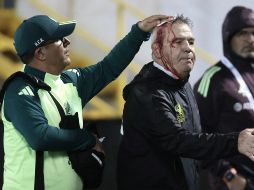 Cuando se acercó a saludar al técnico de Honduras, Reinaldo Rueda, el Javier Aguirre fue golpeado en la cabeza por un objeto, lo que causó que comenzara a sangrar y requiriera atención médica por parte del personal. AFP / J. Magallanes