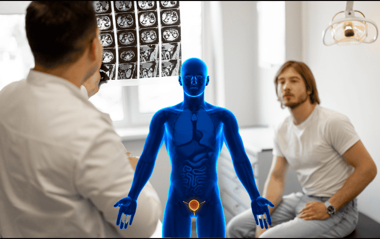 Los especialistas sugieren mantenerse pendiente de estos síntomas para detectar oportunamente el cáncer de testículos. ESPECIAL/ CANVA