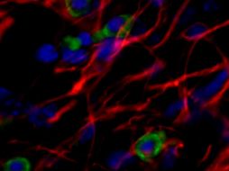 Las conclusiones del estudio se publicaron en la revista Stem Cell Research and Therapy. EFE /  CENTRO DE BIOLOGÍA MOLECULAR SEVERO OCHOA