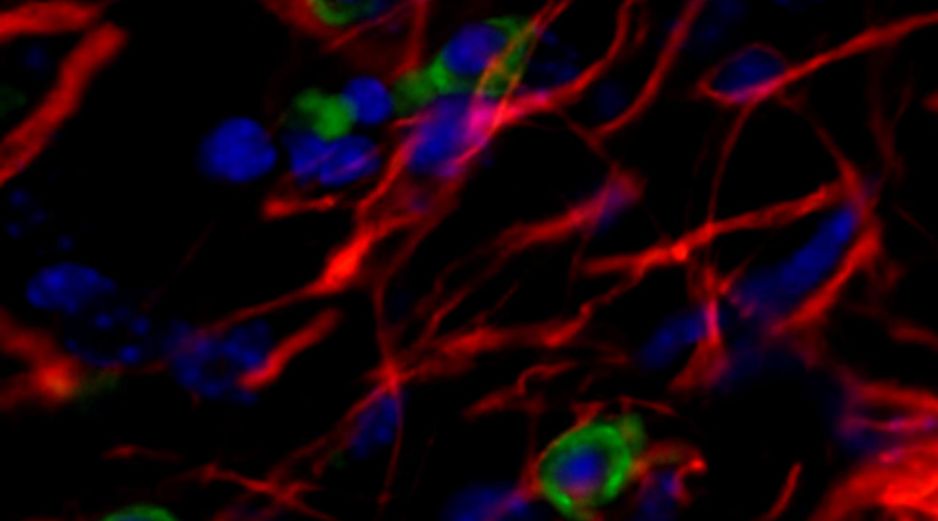 Las conclusiones del estudio se publicaron en la revista Stem Cell Research and Therapy. EFE /  CENTRO DE BIOLOGÍA MOLECULAR SEVERO OCHOA
