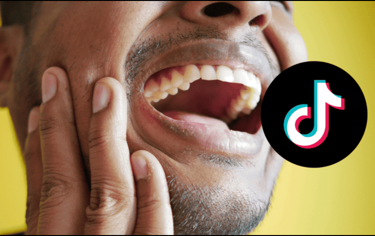 El mewing puede producir dolor en la mandíbula por la presión aplicada con la lengua. PEXELS / CANVA