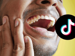 El mewing puede producir dolor en la mandíbula por la presión aplicada con la lengua. PEXELS / CANVA