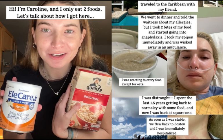 A pesar de todo, Cray mantiene la esperanza de poder expandir su dieta en el futuro. Este es su quinto año siguiendo su régimen de avena, y aunque ha sido una experiencia desafiante, continúa probando alimentos, uno por uno, en un intento por saber si su cuerpo los acepta sin generar reacciones adversas. TIKTOK/carolinecray2