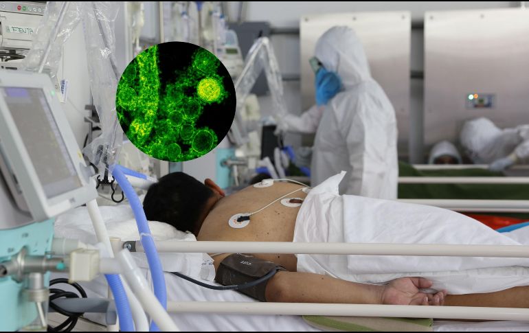 Esta infección si no se trata de manera oportuna y rápida puede incrementar significativamente el riesgo de mortalidad en un paciente grave. SUN / ARCHIVO / ESPECIAL / PEXELS CDC