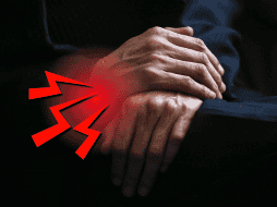 La artritis es la inflamación o degeneración de una o más articulaciones, que deriva en el daño de los cartílagos y en el roce y daño de los huesos. EFE / ARCHIVO