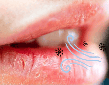 Además de los factores externos, a veces uno mismo provoca la resequedad en los labios. UNSPLASH / T. LITVYAK