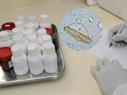 La Secretaría de Salud continúa trabajando en la vigilancia epidemiológica y en la implementación de medidas para evitar la propagación de la bacteria. ESPECIAL/Pexels